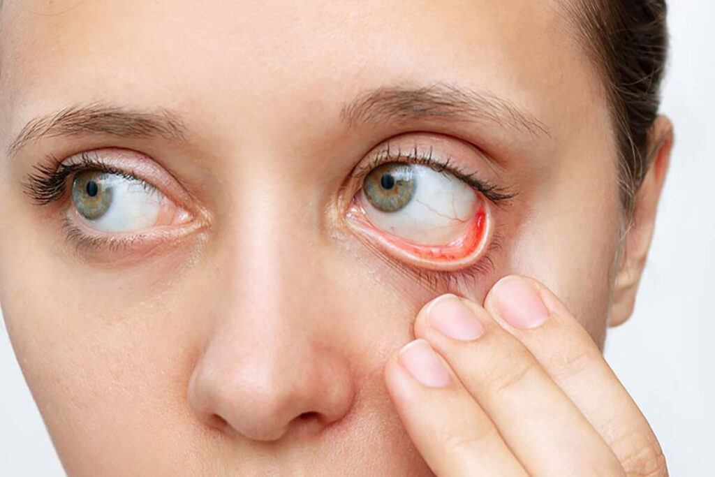 The Complete Guide to Cataracts Surgery: From Diagnosis to Recovery